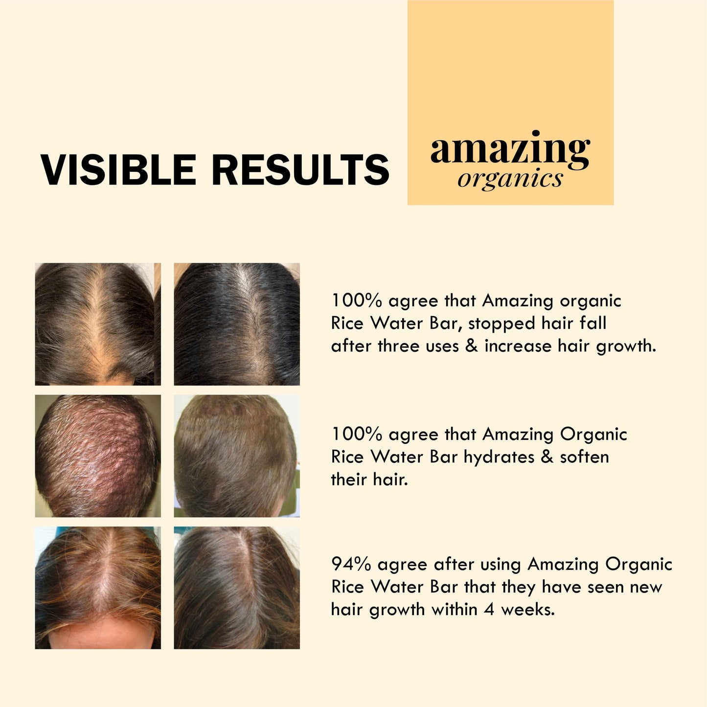 Rice Water Bar - For Hair Growth